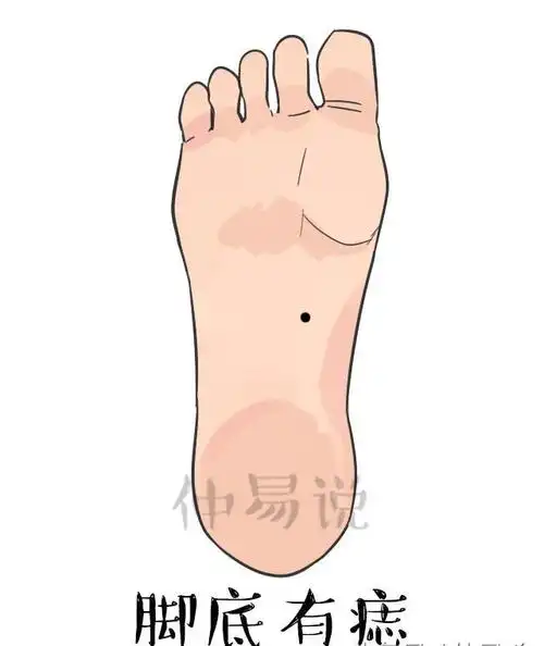 一,脚底有痣