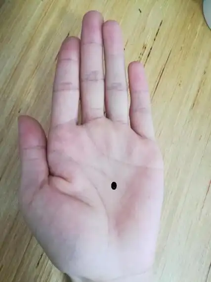 女性左手手掌长痣图解分析手中痣的解释