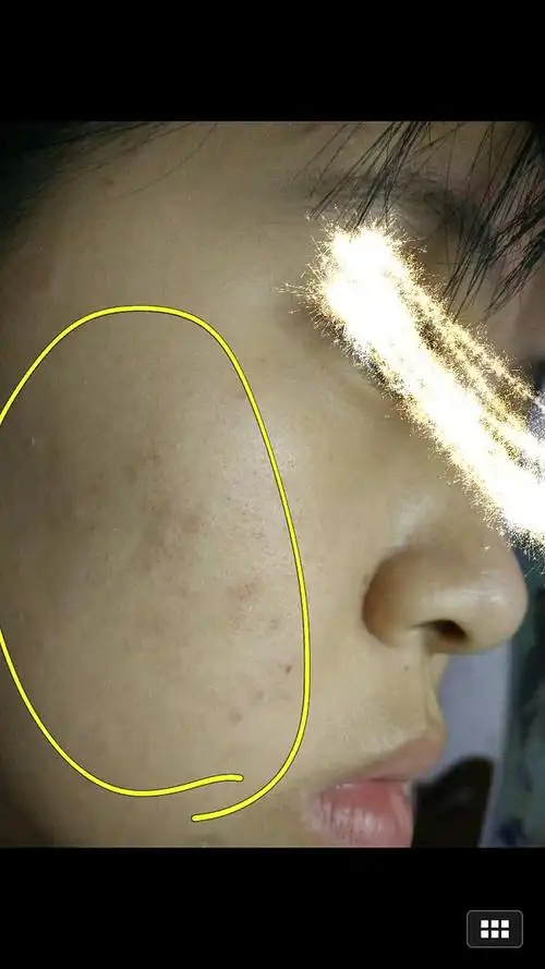 皮肤角质层健康厚实就是好的快!