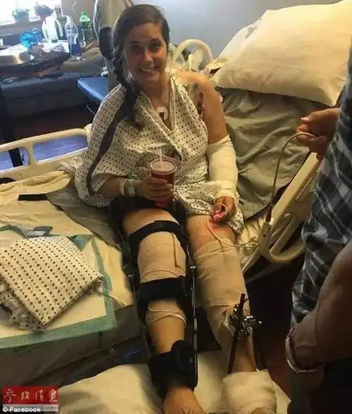 4岁男孩遇严重车祸,体内断头"身首异处"!这个时候奇迹发生了!