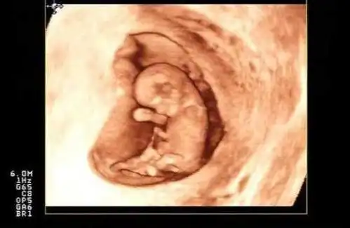 2:b超的准确性有误差胎儿在4个月的时候就可以检测到性别了,其中男