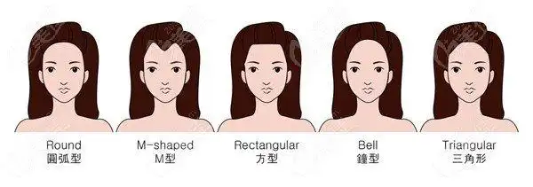 发际线后移m字发际线的看过来花瓣形圆弧形哪种更好看