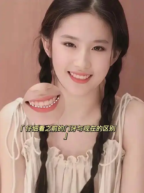 今天我们来说一下刘亦菲的牙齿刘亦菲的牙齿,梦华录里边你会发现她的