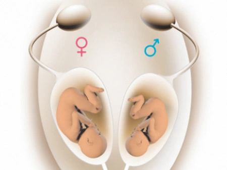 原创在孕期判断胎儿性别,通过肚形或者口味?这样的判断一定要注意了