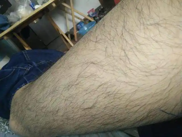 为什么有的女性体毛旺盛有的却光秃秃哪类人更健康