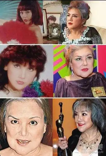 下巴整形失败的女明星:艳星变巫婆图