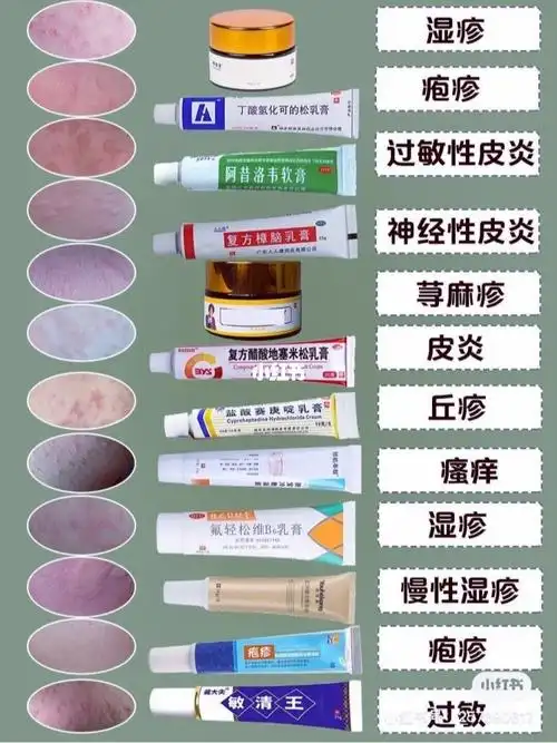 家庭必备湿疹膏测评一健解决湿疹问题