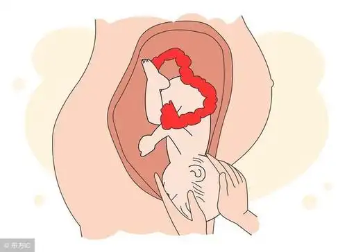 怀孕32周胎儿提早入盆了,入盆是什么感觉?早入盆会早生吗?