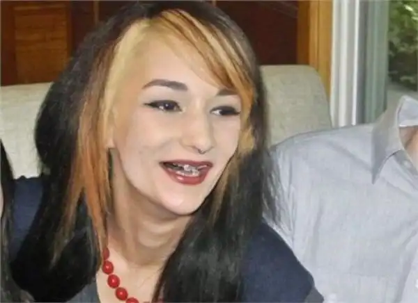 女子天生长着一副鲨鱼牙齿自卑了10年都不敢笑如今解脱