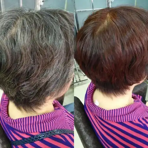 白头发养发前后对比