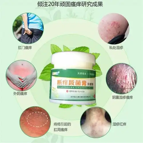 肛门湿疹治股癣药膏抑菌止痒皮肤私处成人大腿内侧痒湿疹瘙痒
