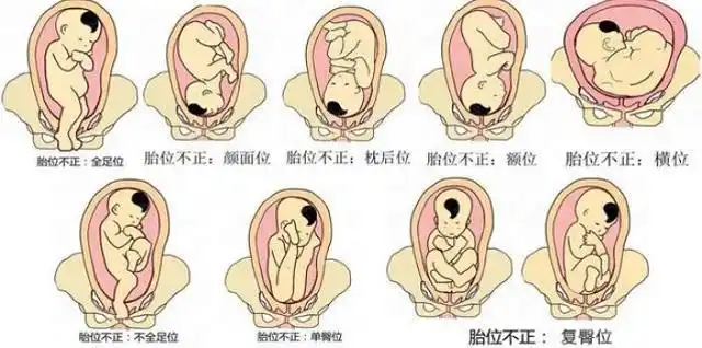 原来身体如此奇妙|分娩|胎儿|顺产_新浪新闻