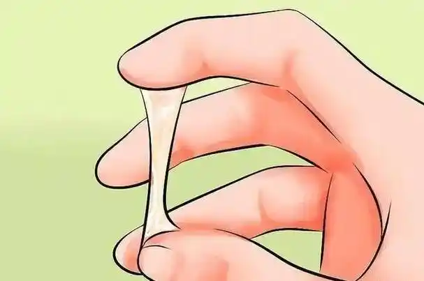 豆腐渣样白带白带中混有豆腐渣样的白色块状物,伴有外阴瘙痒,灼热