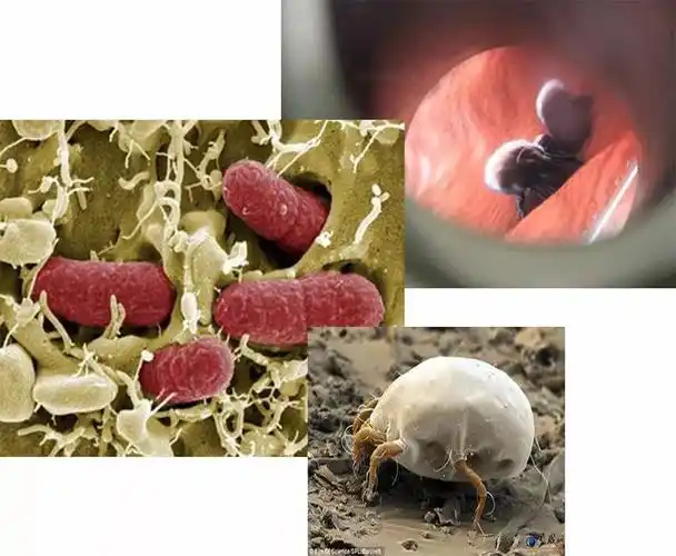 你知道吗?双手洗净后还有 182种细菌,光指甲里的细菌就达 38亿个!