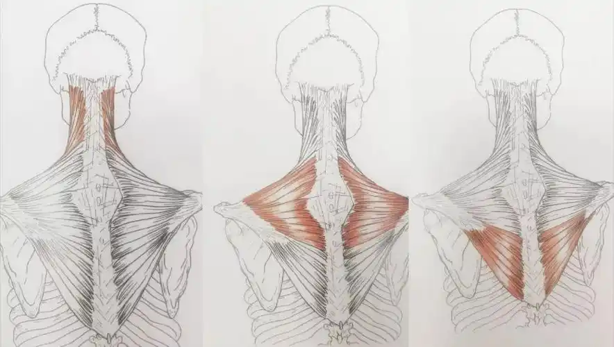 斜方肌紧张颈后大包上交叉综合征造成虎背熊腰的原因都在这了