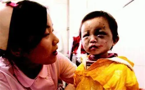 青海小苏丽3岁被针线缝嘴5岁被虐死母亲出狱后将其挫骨扬灰