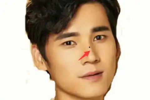 太阳穴长痣的男人天生就是一个浪漫多情的人,在感情当中也是纠纷不断