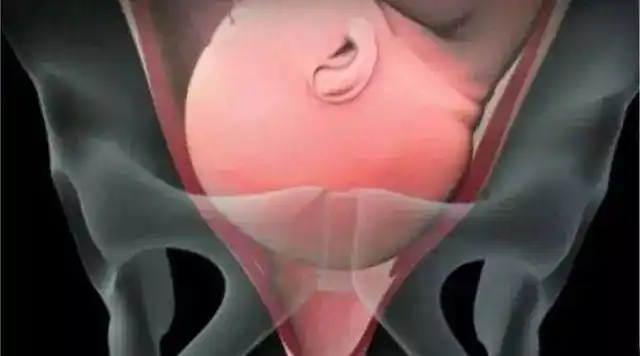 这些信号被称为"临产先兆"1信号1,入盆初产妇胎儿一般会在第36周入盆