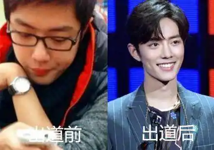 歌手超级包装肖战阿云嘎都不算什么周深整容式逆袭