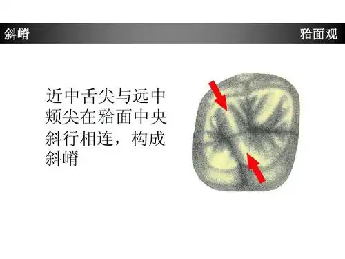 上颌第一磨牙牙体形态简述ppt