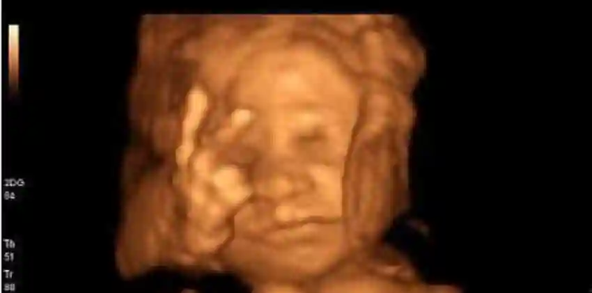 听说可以从四维彩超图片看胎儿容貌是真的吗