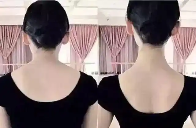 你含胸驼背的样子真是丑爆了每天2戴它小时抬头挺胸舒肩开背气质upup