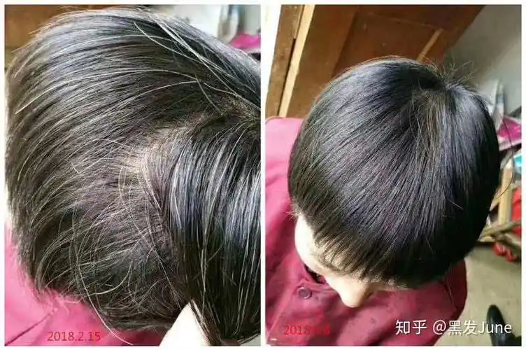 白发对比的效果! 有对比才会有效果! - 知乎