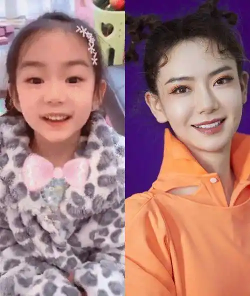 lucky"整容式"长大,本以为复制戚薇的模样,没想到美出新高度_小孩子