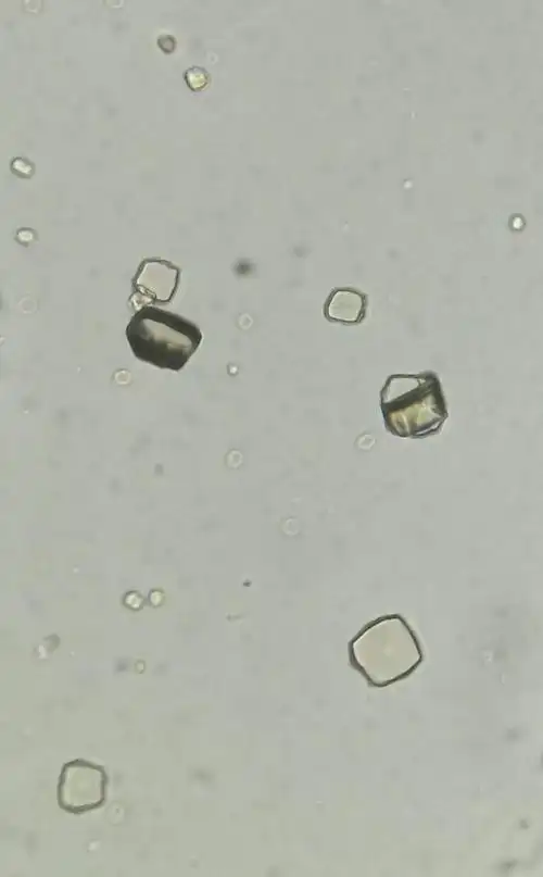 尿酸结晶#普/相差#低/高/油镜观察