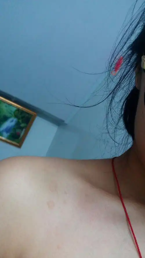 这个一圈一圈圆圆的疤痕是长出来的,为何?