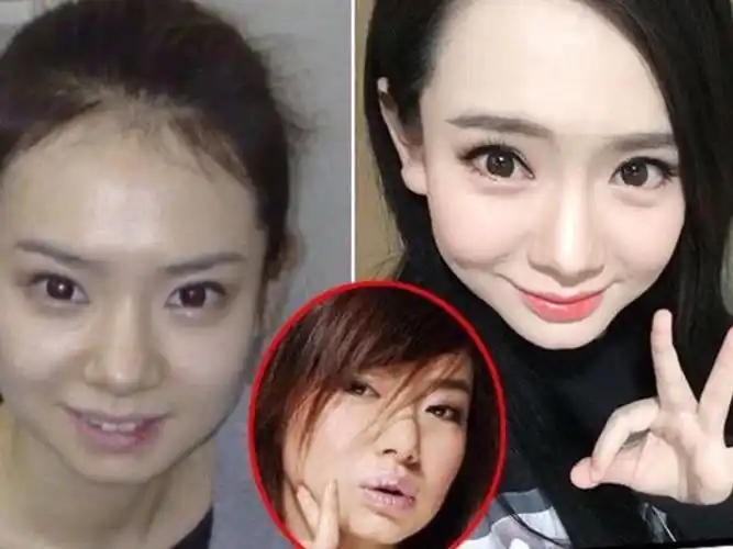 戚薇也是一个精致的大美人却执着于割双眼皮导致越来越宽肉条感也变重