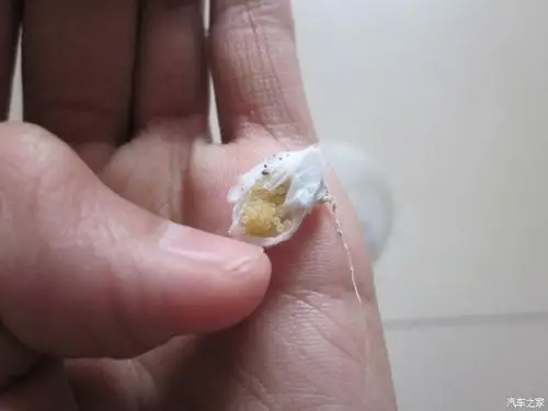 百度一下 蜘蛛卵长这样