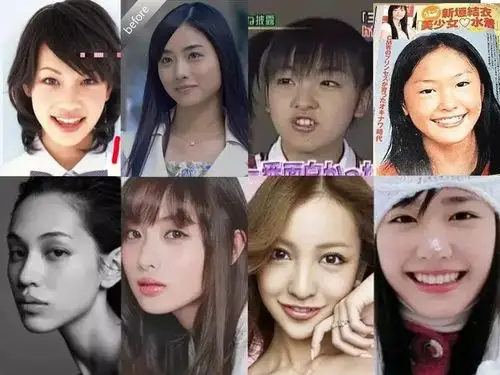 还得再说日本的整容术,比起中国和韩国,日本真的很懂整容的道理.