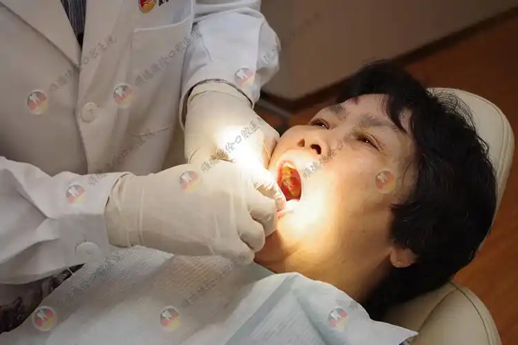 种牙案例:六旬老人德伦半口种植牙 - 顺德德伦口腔医院