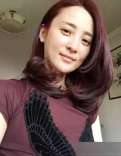 蒋勤勤拍戏受伤 晒淤青称:我也是醉了!(5)