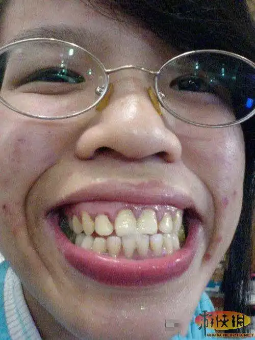 重口味慎入!网络20大极品丑女 凤姐未进前五