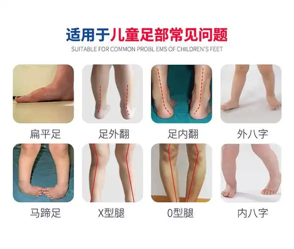 【药房直售】儿童内八字鞋垫扁平足外翻垫xo型腿器宝宝足弓垫男女 34