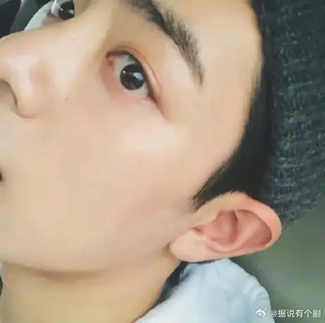 天然眼睑下至大眼睑又时常能带来眼尾的自然高光卧蚕也非常饱满#肖战