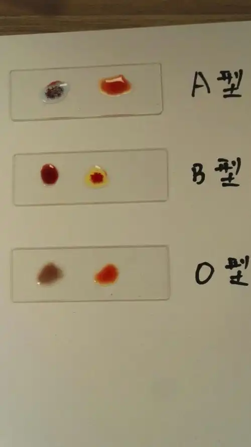 国庆节十月一号,免费测血型