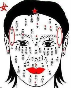 夫妻宫有黑痣面部多斑点及脸上痣太多的详解