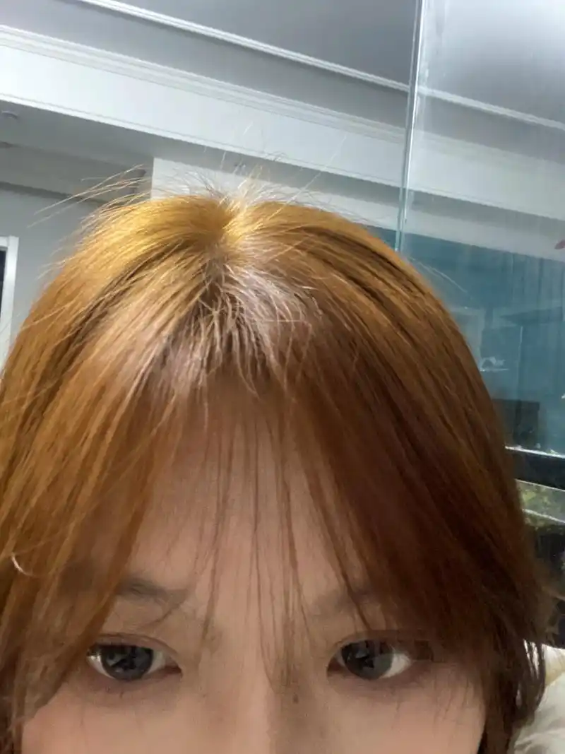 染发爆顶了怎么补救 现在这头顶纯纯精神小妹真的服了