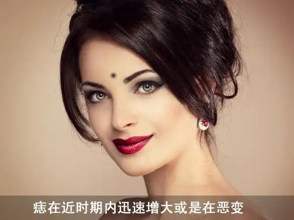 10,悄悄变化的美人痣