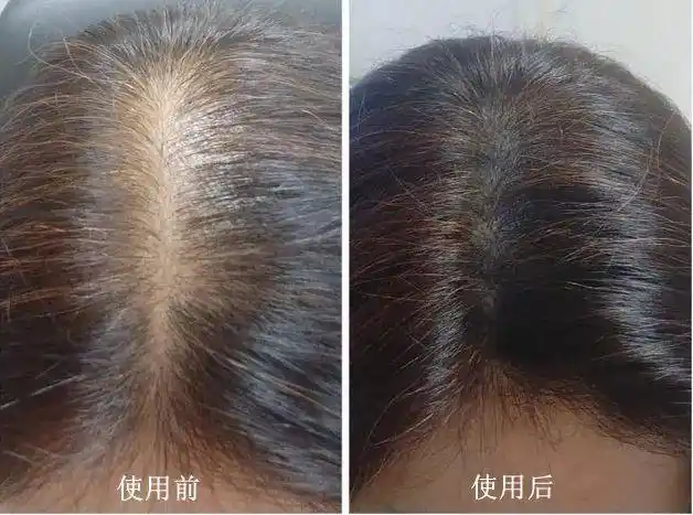 德国94岁老太从来不用洗发水,却有一头浓密乌黑的头发,只因每天用它洗