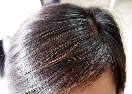 女性一长白头发,就觉得自己老了?不用慌张,可能是缺这3种营养