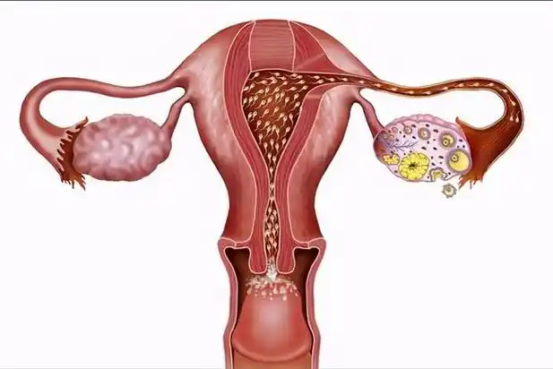 博大!多囊卵巢能生孩子吗"翻来覆去"-第2张图片-益齐网