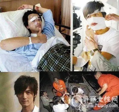 胡歌车祸前后照片_胡歌车祸前后对比图_胡歌车祸现场