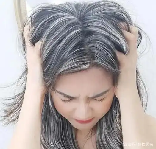 这3个原因不容忽视|白发|掉发|穴位|黑发_网易订阅