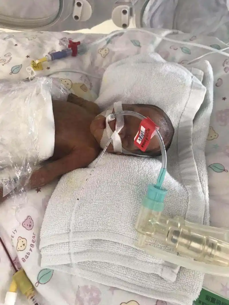 全阜阳最小妈妈怀孕6个月产下男婴10张照片张张让人落泪