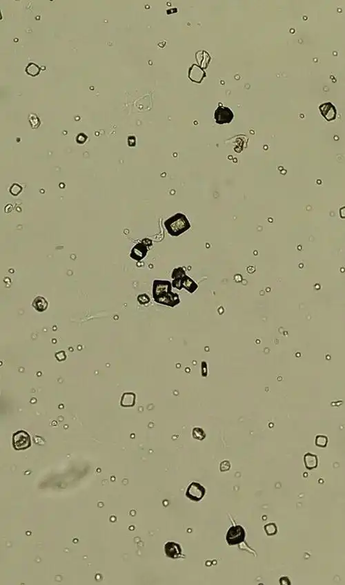 尿酸结晶#普/相差#低/高/油镜观察