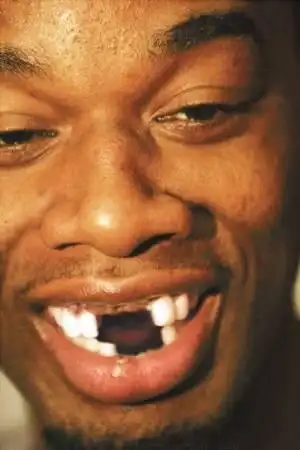 图为他没了五颗牙之后的ps图片